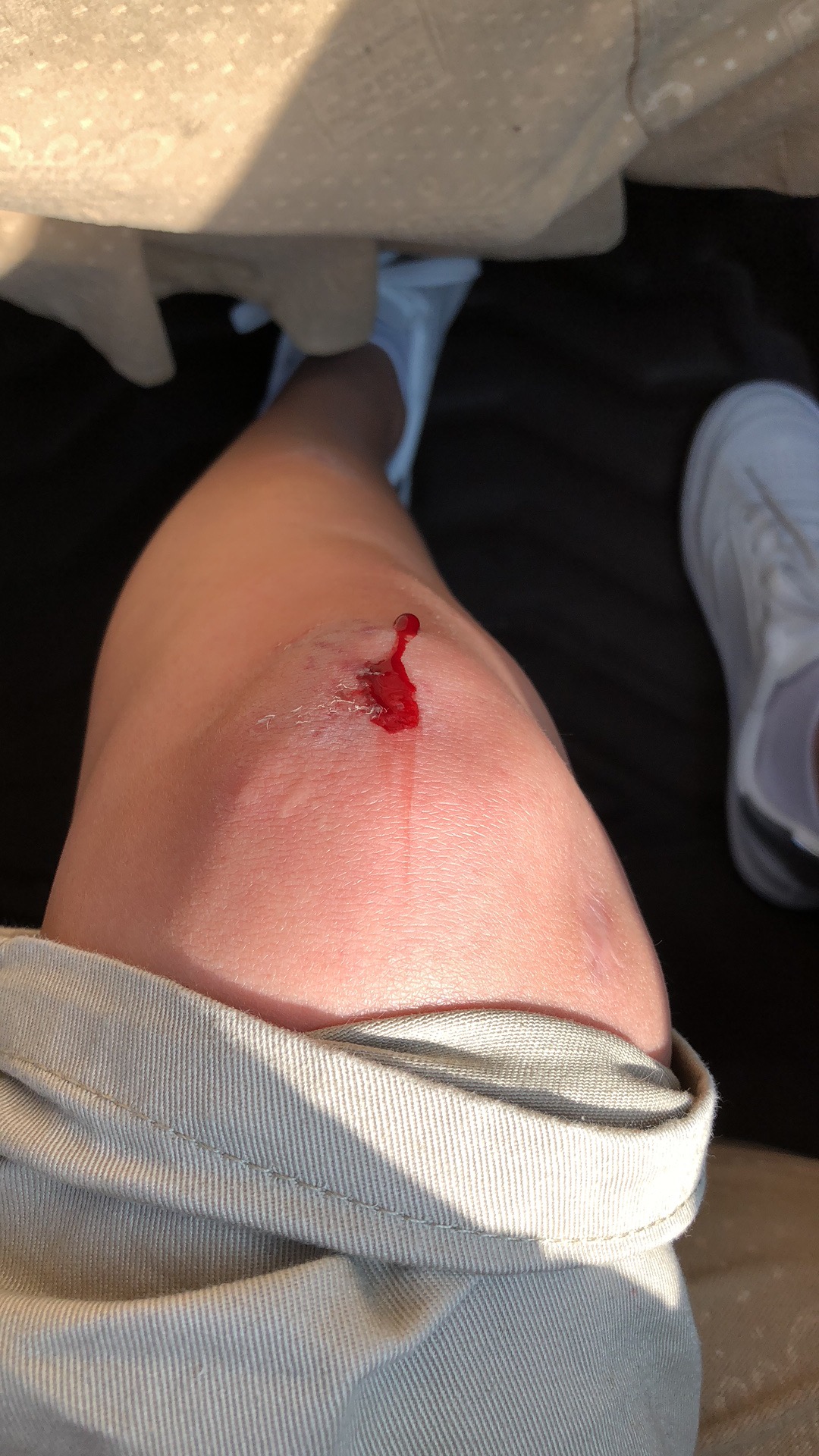 眼酱大魔王w 合集2 - 2-脸照和杂图_第1集