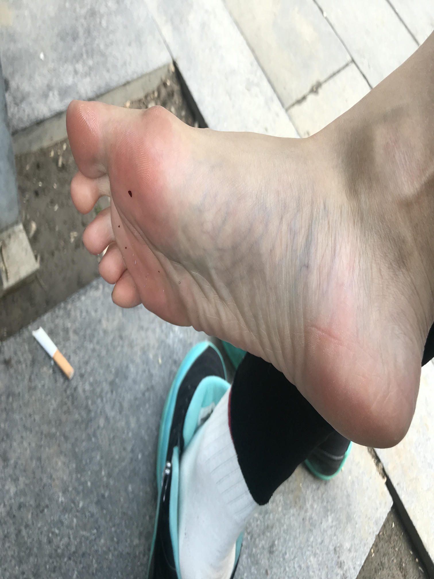 安乔乔 NO.002 户外露脚脚 [104P+304M]_第3集