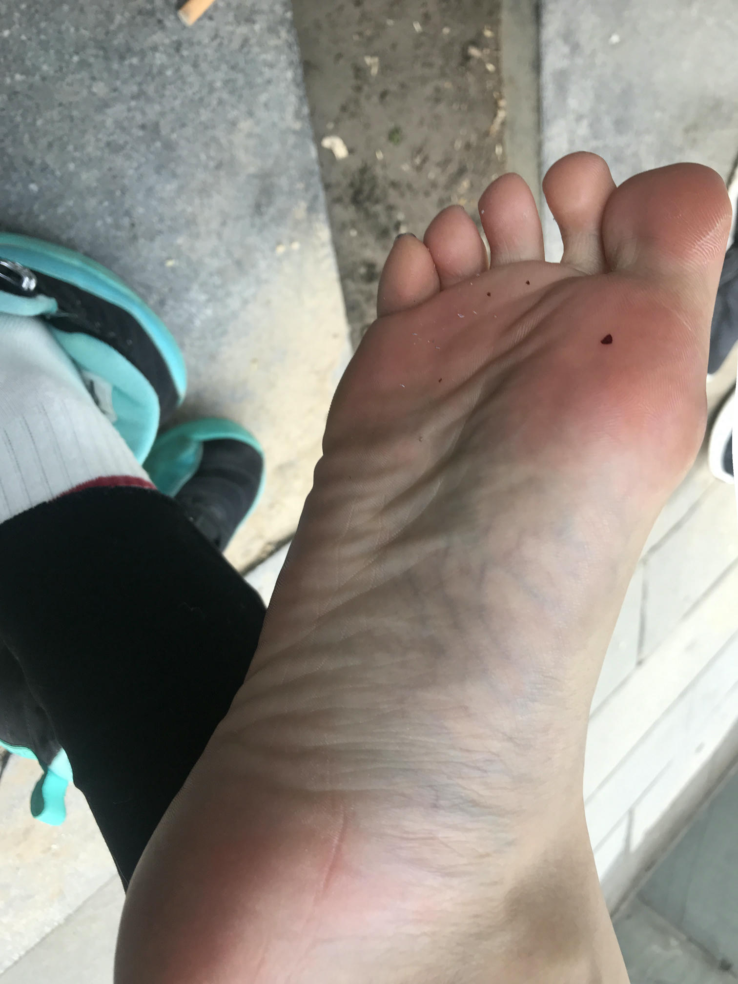 安乔乔 NO.002 户外露脚脚 [104P+304M]_第3集