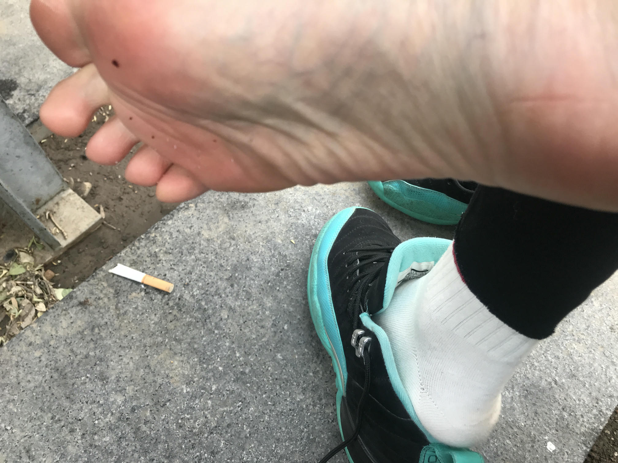 安乔乔 NO.002 户外露脚脚 [104P+304M]_第3集