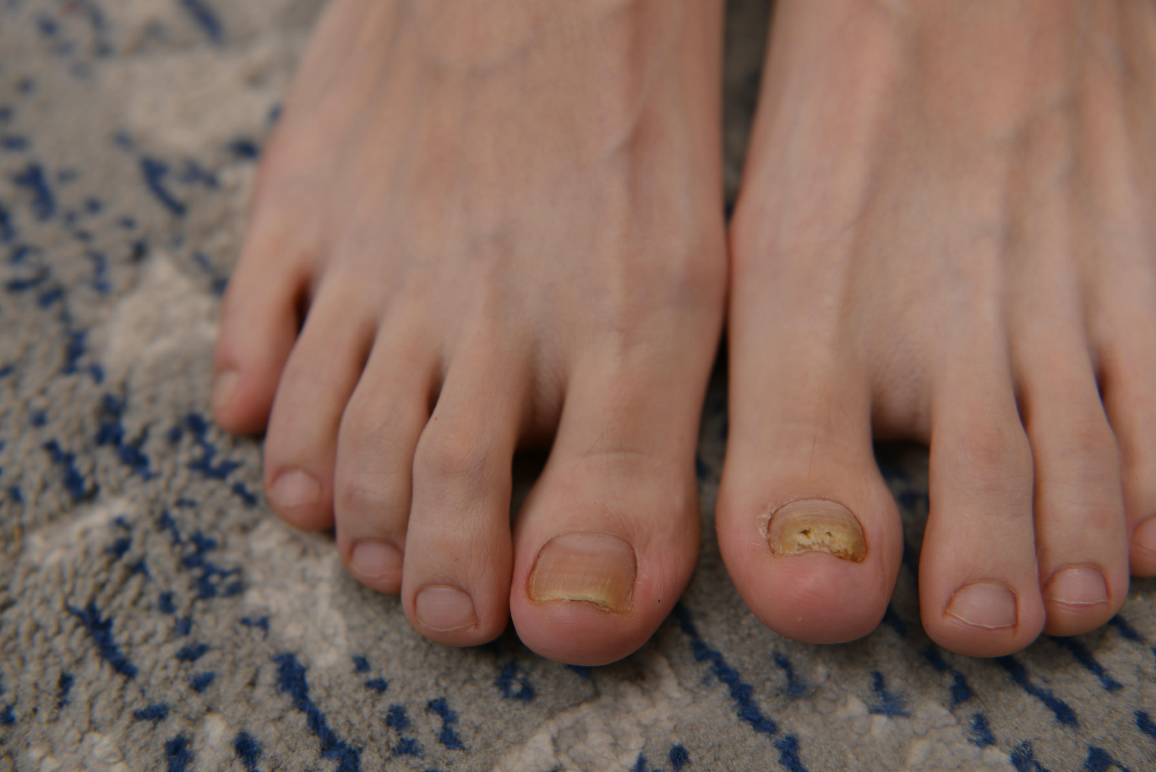 Sexy Asian Girls Feet NO.005 大脚妹沫沫的大脚丫 [158P+-1993M]_第3集