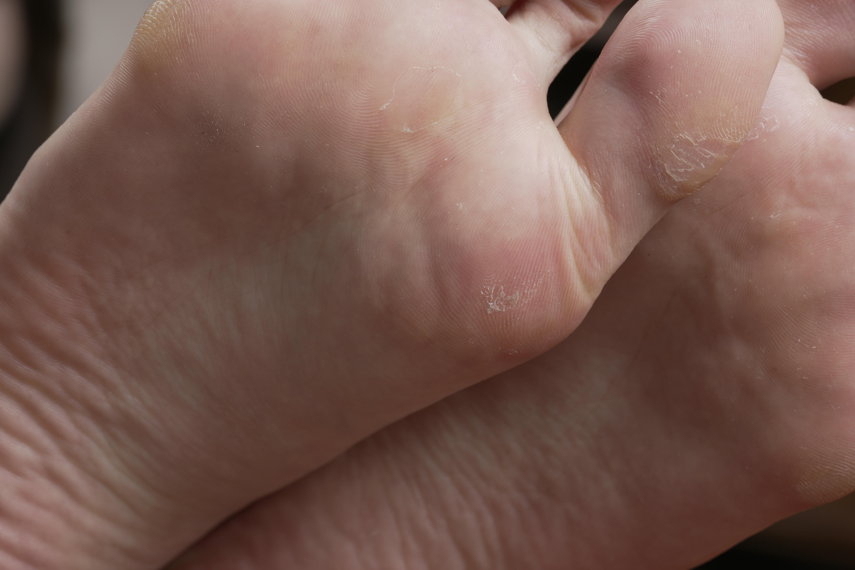 Sexy Asian Girls Feet NO.008 李晓丽展示她的性感的39码大脚丫 [119P+-1993M]_第5集