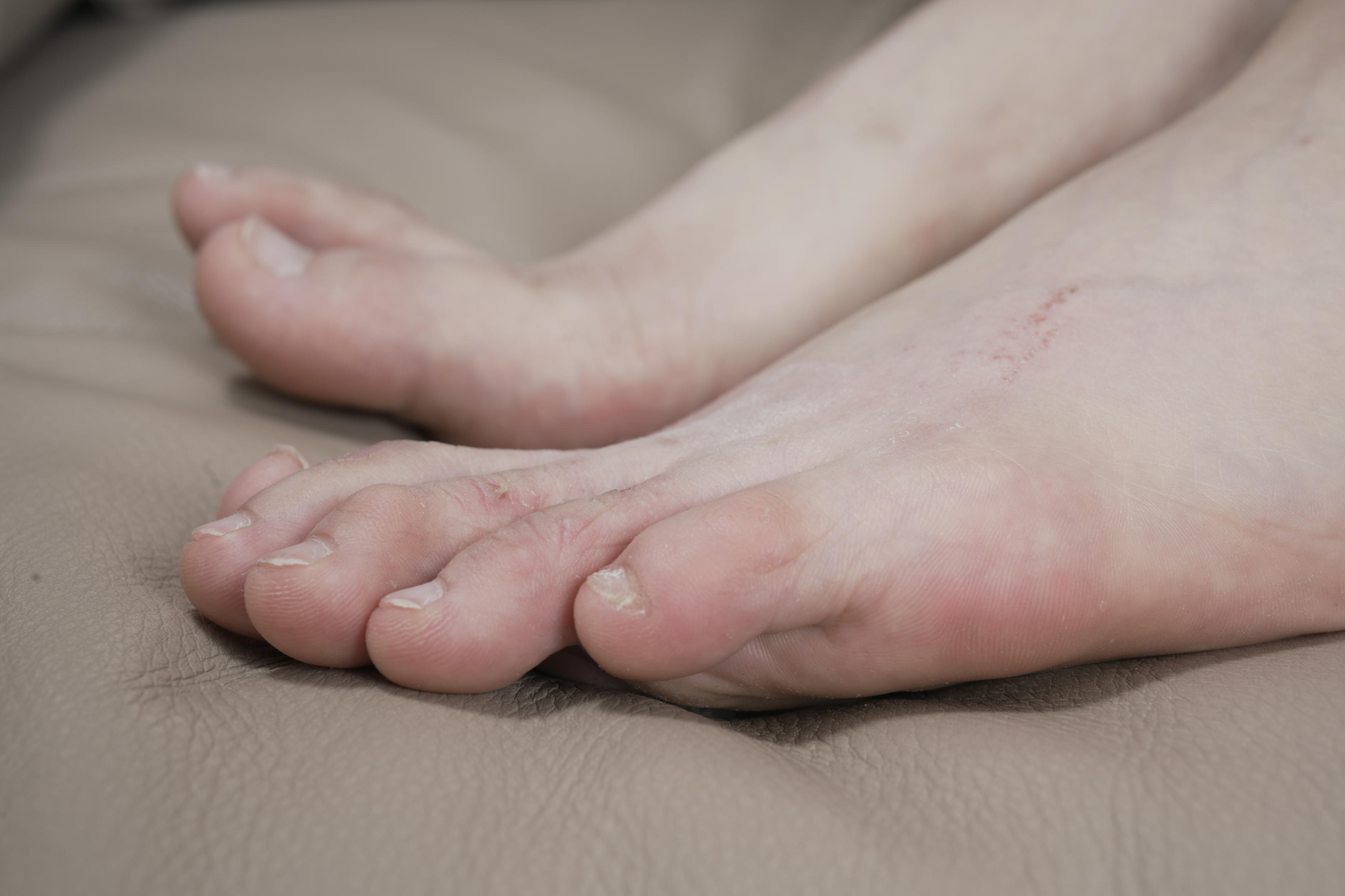 Sexy Asian Girls Feet NO.031 小女生令仪展示她的有伤痕但挺性感的脚丫子 裸足[143P-2.42G]_第7集