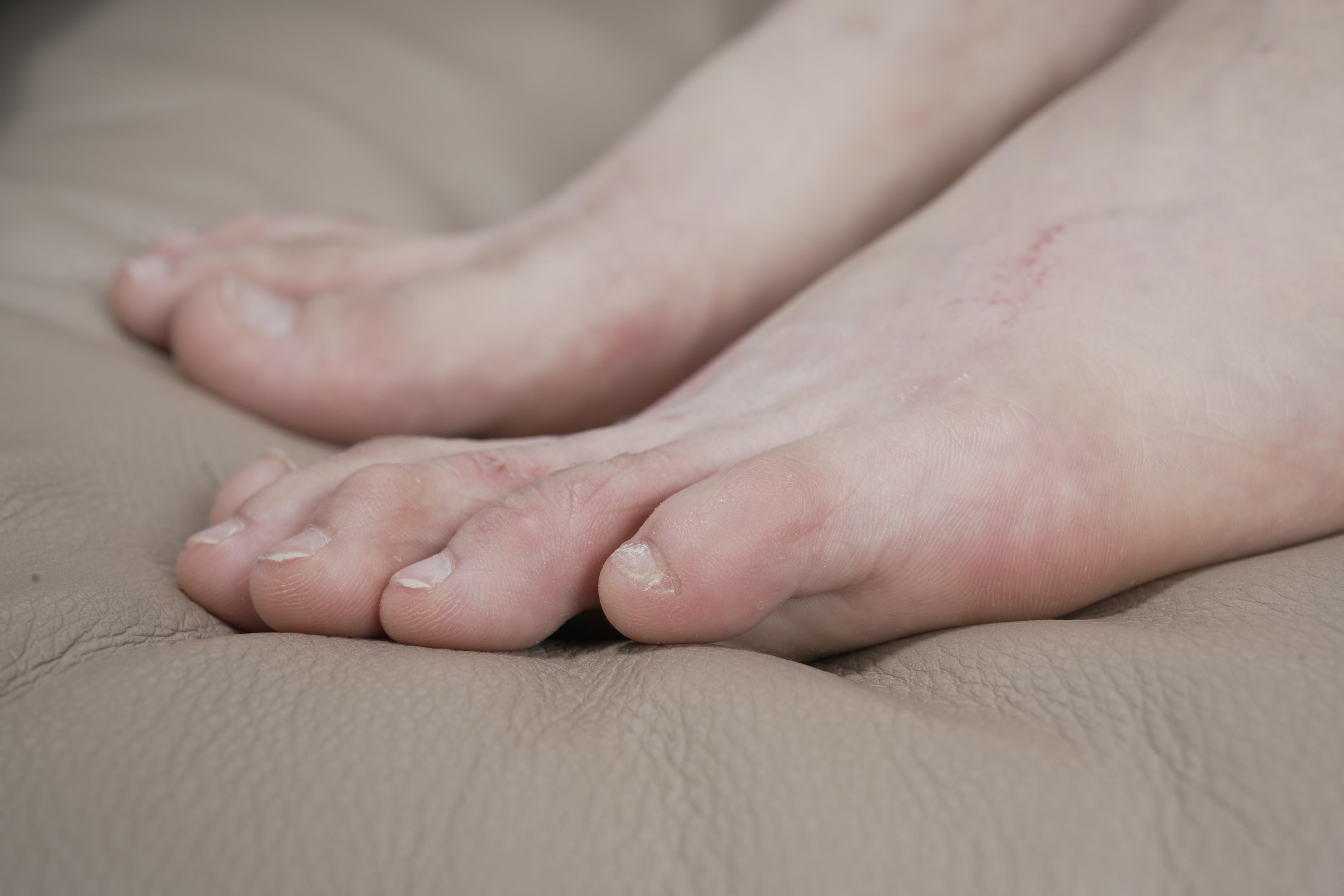 Sexy Asian Girls Feet NO.031 小女生令仪展示她的有伤痕但挺性感的脚丫子 裸足[143P-2.42G]_第7集