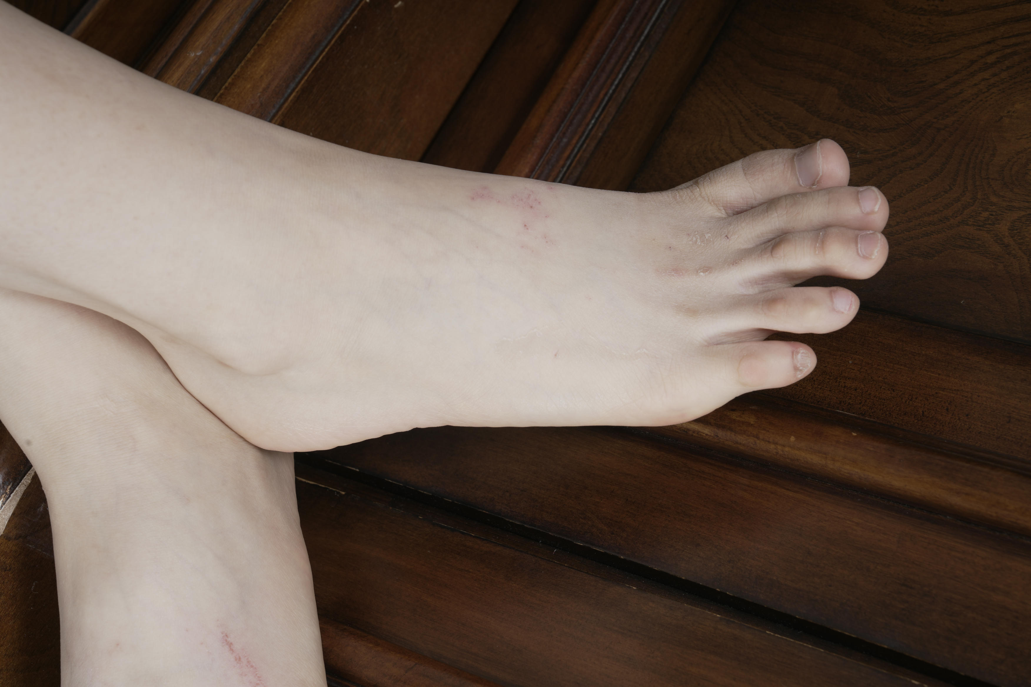 Sexy Asian Girls Feet NO.031 小女生令仪展示她的有伤痕但挺性感的脚丫子 裸足[143P-2.42G]_第2集