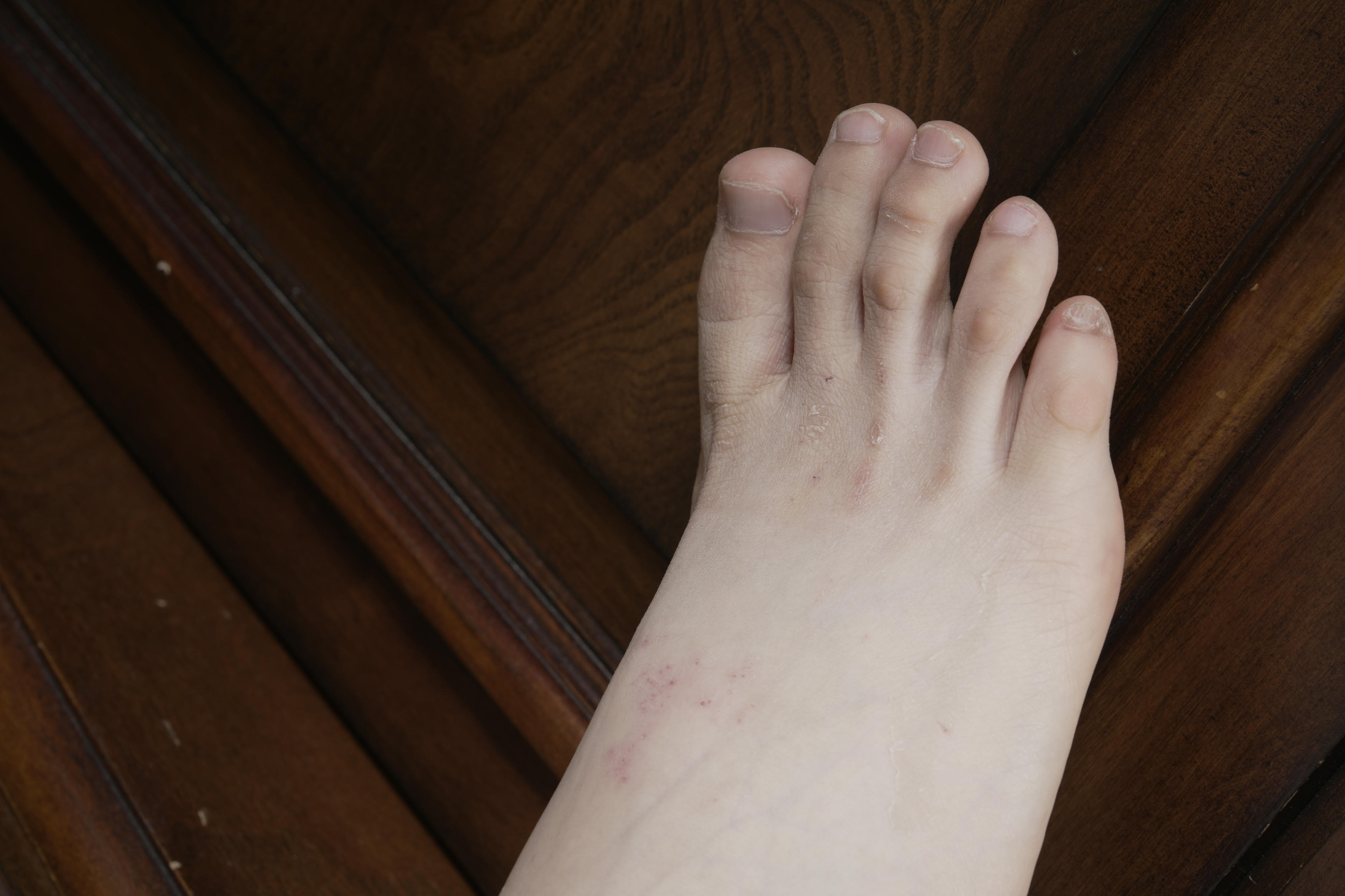 Sexy Asian Girls Feet NO.031 小女生令仪展示她的有伤痕但挺性感的脚丫子 裸足[143P-2.42G]_第2集