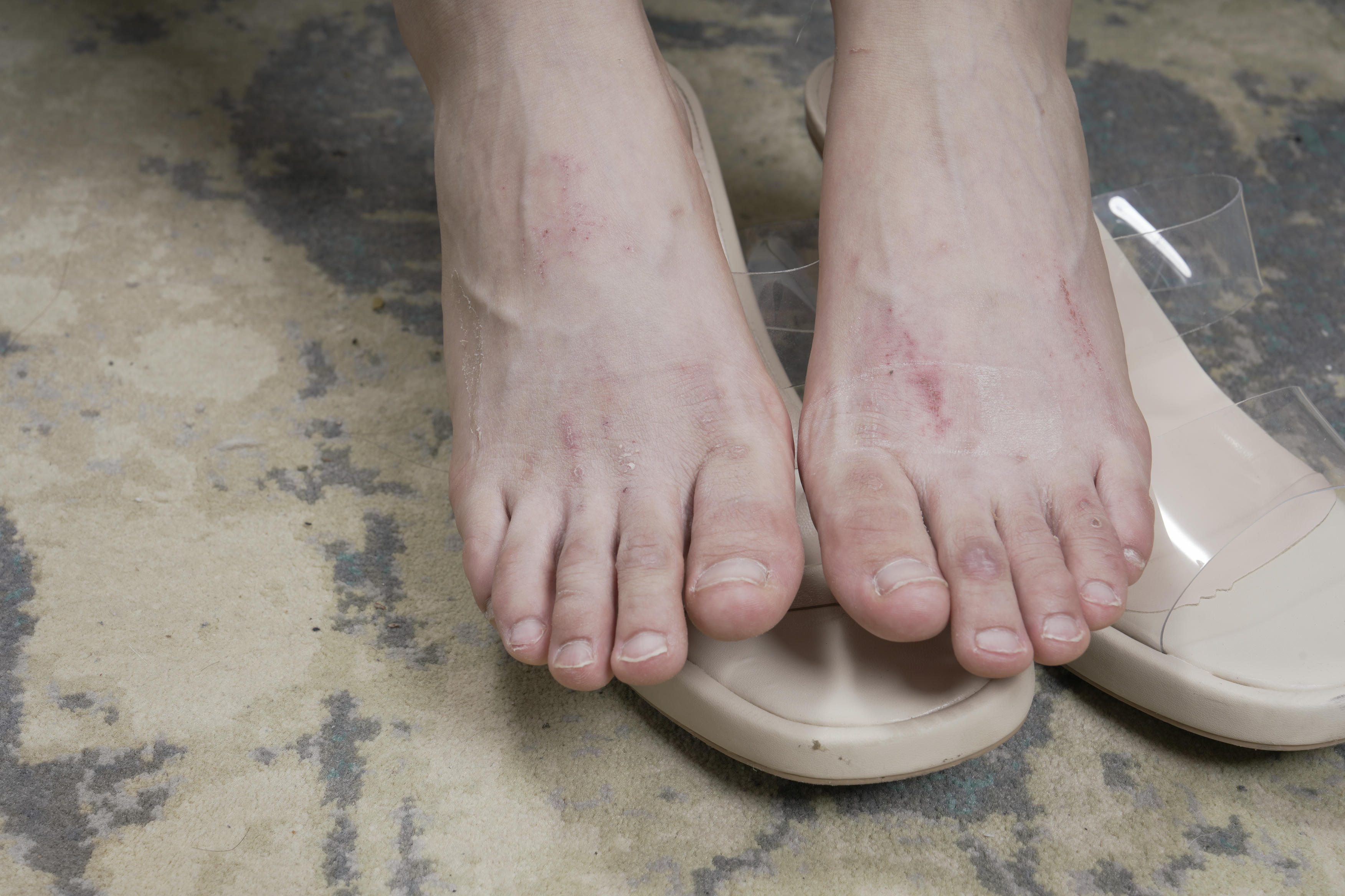 Sexy Asian Girls Feet NO.031 小女生令仪展示她的有伤痕但挺性感的脚丫子 裸足[143P-2.42G]_第1集